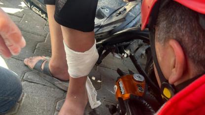 Elektrikli Bisikletin Pedalı Çocuğun Bacağına Saplandı!